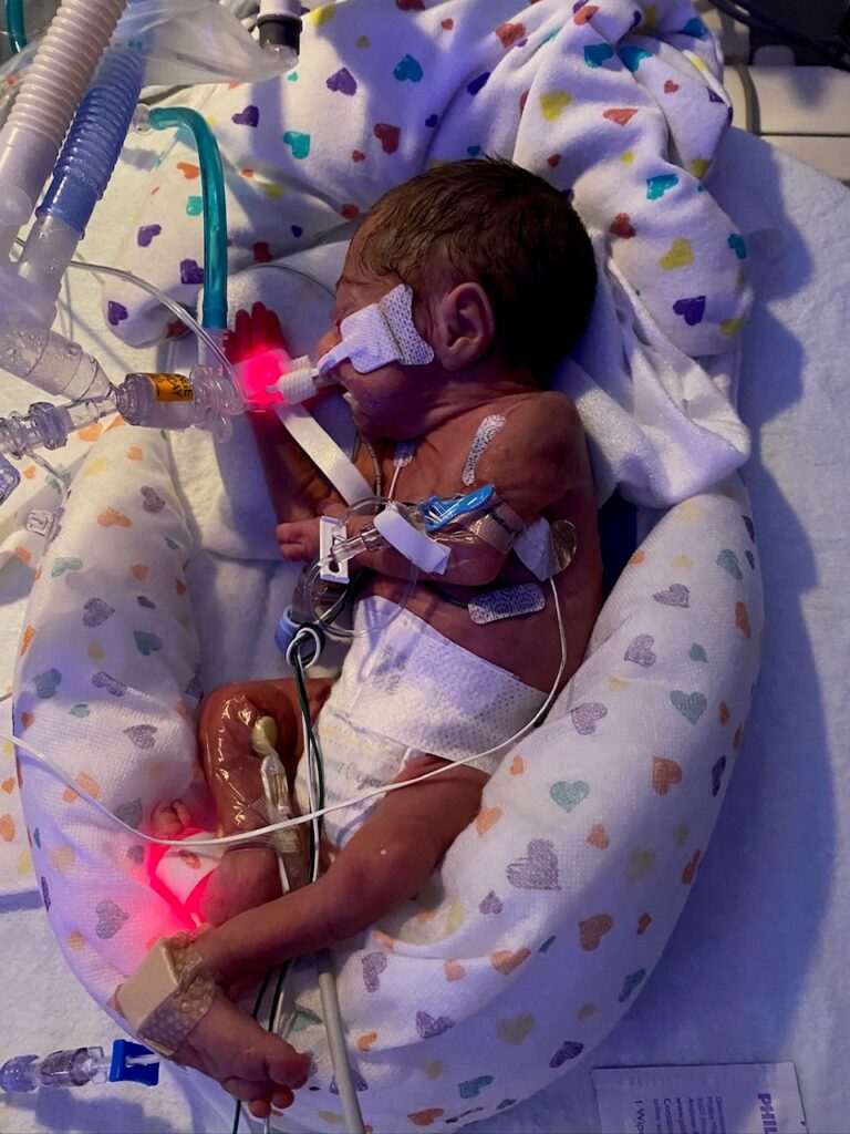 Sofia at birth